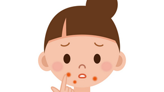 なんとなくのケアでは意味が無い！ニキビのできる場所から判断する原因とケア方法