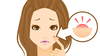 女性・男性共通の悩み！ニキビレス美女のケアの秘訣は新型ビタミンC誘導体「APPS」にあった！