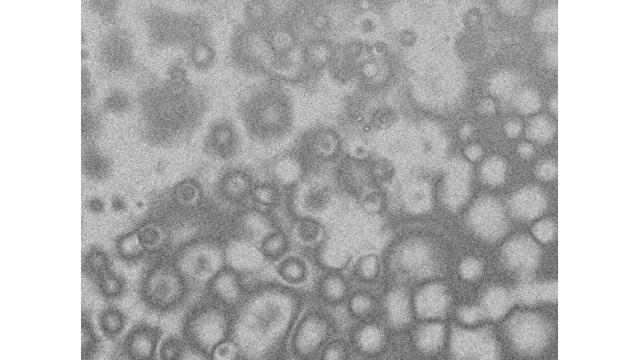 米インディレスラー悲痛の告白「コロナウイルスなんて他人事だった。自分がかかるなんて」