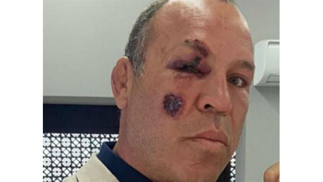 続・タイソン騒動…クリス・ジェリコと乱闘、ヴァンダレイ・シウバは反ANTIFAを叫び、交通事故に遭う