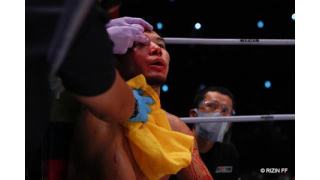 壮大に転んで恥をかいた斎藤裕に見えた華