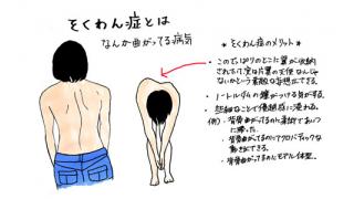 フリー公開 総合格闘技と脊椎側弯症 二階堂綾乃のオールラウンダーayano Dropkick Dropkick チャンネル Dropkick編集部 ニコニコチャンネル スポーツ