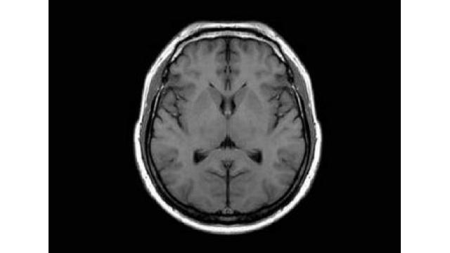 全日本美脳コンテスト　最年少１８歳がグランプリ