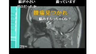 生主ブロマガ放送　横山緑『脳検査』の結果　再検査となる！！
