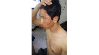 韓国の大学教授が部下に対し2年間にわたり暴行と人糞を食べさせるなどで解雇