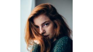 繰り返されるニキビにうち勝った話［体験談］