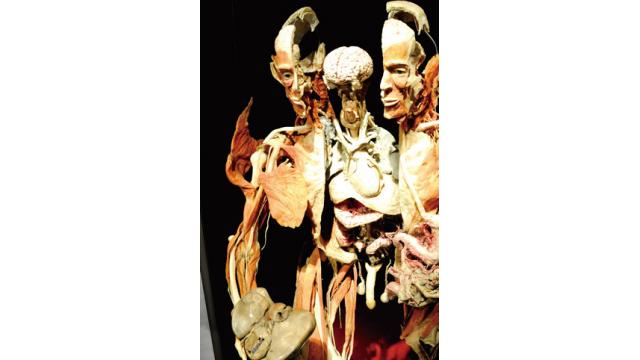 ドイツ・グーベンに「人体標本」の制作現場を見に行く～前編