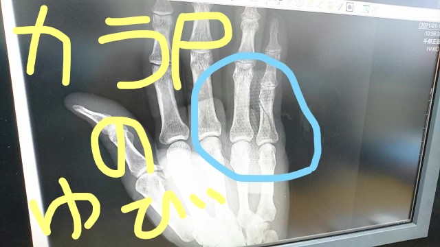 カラPによる体を張らないブログ　～バンジーとカフェラテと私～