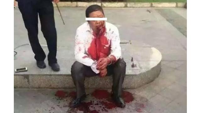 衆人環視の中で女性の腹を裂き腸を引きずり出した男 衝撃的という理由で広告剥奪された記事